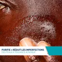 CeraVe Gel Visage Anti-Imperfections Peaux Acnéiques Moussant (236 ml) thumbnail 3