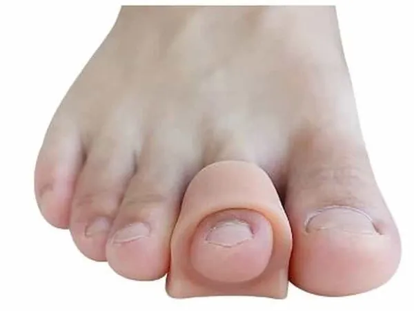 Coussin protecteur des pieds hallux valgus, bague de protection des orteils